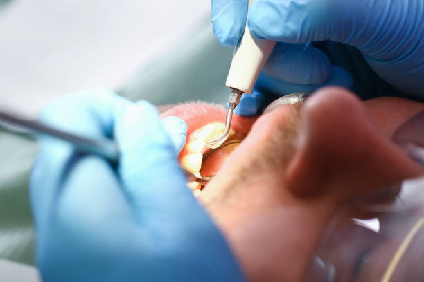 Best Emergency Denture Repair in Frankton, IN