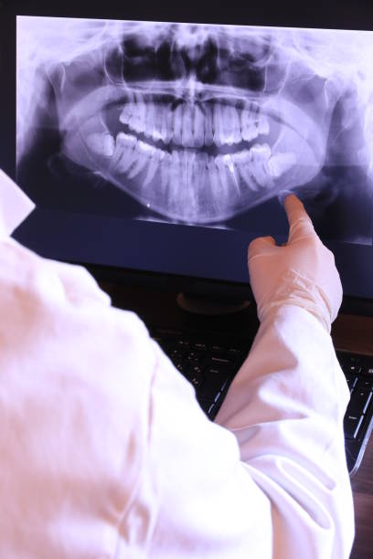 Best Emergency Dental Care for Broken or Chipped Teeth in Frankton, IN