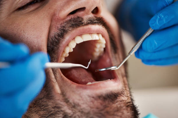 Best Pediatric Emergency Dentist in Frankton, IN